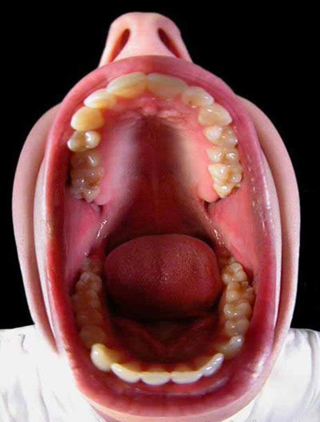 Conoce tu boca y previene el cáncer oral (para NO odontólogos) V5
